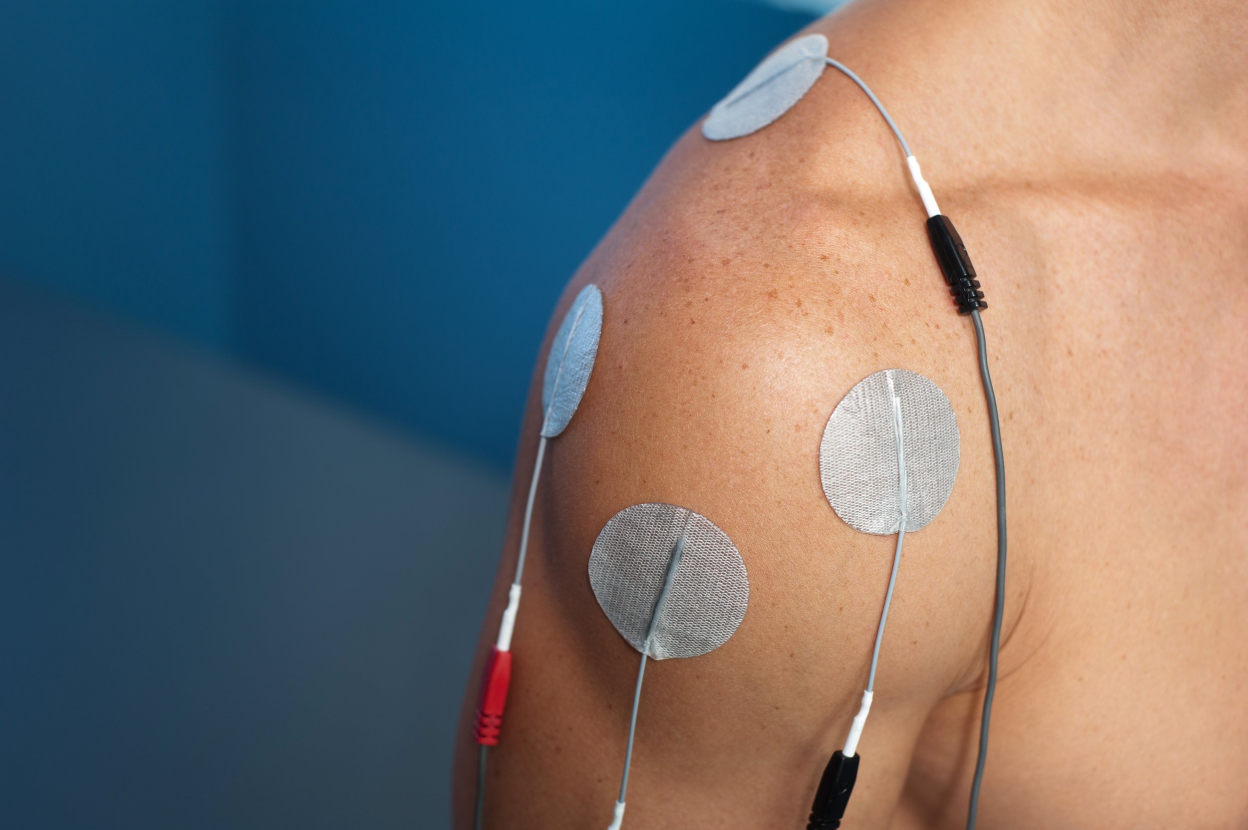 Electric Muscle Stimulation (EMS) treatment at Keep It Kinetic Chiropractic